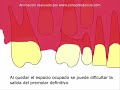 Importancia de mantener los molares de leche hasta recambio Importancia de mantener los molares de leche hasta recambio