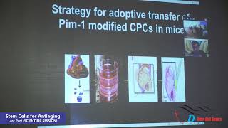 Stem Cells for Antiaging (Last Part)