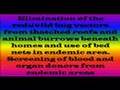 cardiovascular and lymphatic infections part7