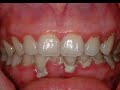 Dental Hygiene