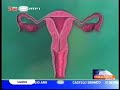 Vacina Cancro Colo do Utero