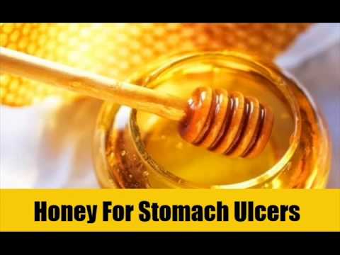 how to treat a stomach ulcer