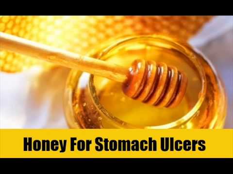 how to cure ulcers