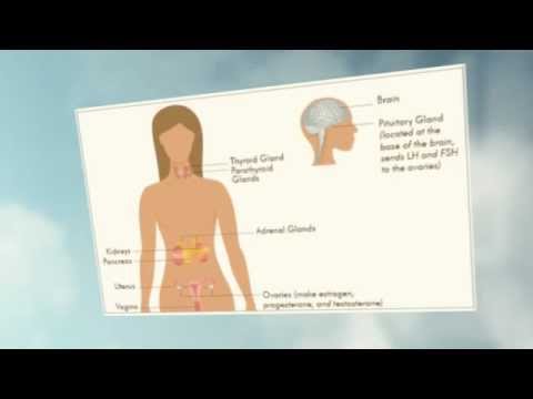 how to get rid of pcos naturally