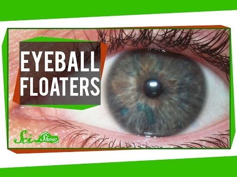 how to dissolve floaters in the eye