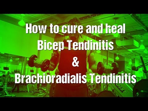 how to cure bicep tendonitis