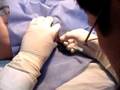lumbar puncture