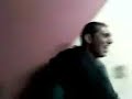 FACA NA CAVERA E FERIDA NA CABE�A