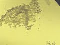 Unknown Marine Protozoa