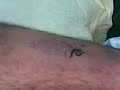 Tatoo