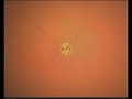 3d animation of the human body

fantastic graphic interpretation!

designed in  maya 3d.

artists were axel gaul, alf neu, stefan gruschke and fritz hombach.
http://www.youtube.com/user/25041969
thanks


*
