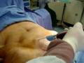 videos de -dr. kamal saleh-alemdi hospital-qatar-lipo suction