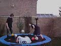 Trampoline accident - Fractured skull