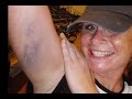 Albany All Stars - Video 1 Albany All Stars - Video 1