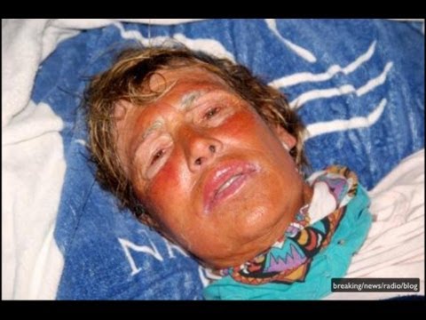 danewz1 - Nyad quits swim after storm jellyfish stings Breaking News Radio Blog Diana Nyad performed a