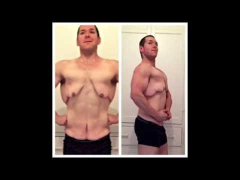 how to lose excess skin