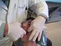 Braces off - removing Alec's braces at Braces by Bergh by Dr. Brian H. Bergh, DDS, MS