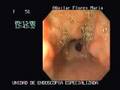 erosive gastritis