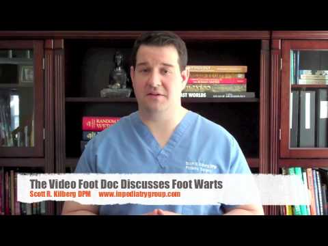 how to cure warts on feet
