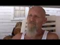 Interferon Riddled Ronnie part 3 Guinea Pigs