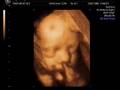 Daniel's 4D Scan