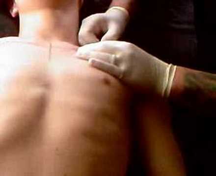 :D First a friend of mine gets his nipple re-pierced, then I get my surface 