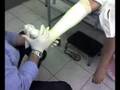 ESGUINCE DE TOBILLO GRADO II