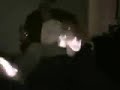 foot fire