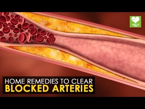 how to treat clogged arteries