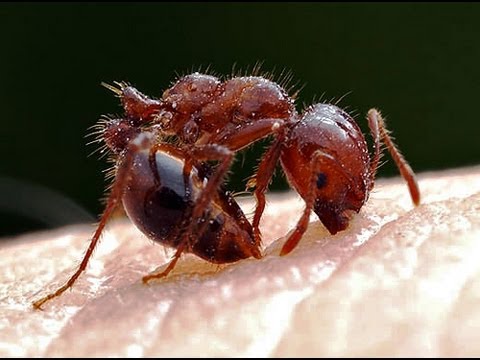 how to treat fire ant bites
