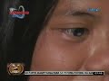Abogado, gustong ibigay ang cornea sa dalagitang may problema sa paningin