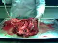 Lung Inflation with pig pluck Lung Inflation with pig pluck