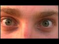 Thumbnail #1