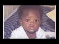 Cleft Lip/Palate Awareness Video