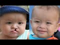 Cleft Lip/Palate Awareness Video