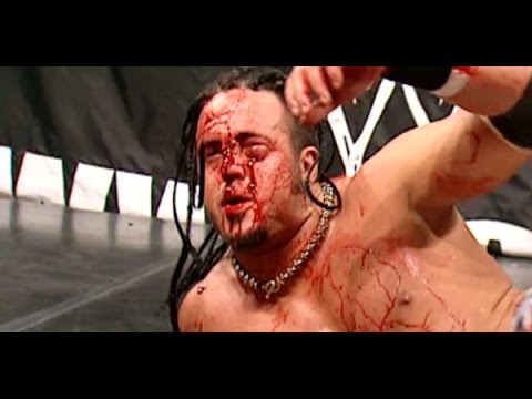 10 Worst Botches In WWE History