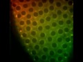 Mitosis  real life cells dividing