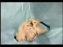 Intestinal Anastomosis, intestine repair connell suturing: connel lembert suturing of intestines