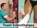 if you're embarrassed about unsightly spider or varicose veins, there are options that can help. let's look at them.