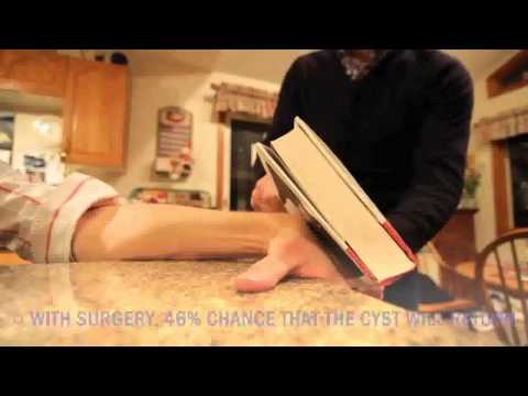 how to drain ganglion cyst