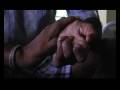 Lepra Health in Action - Leprosy