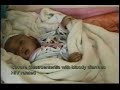 Neonatal Care in Ethiopia