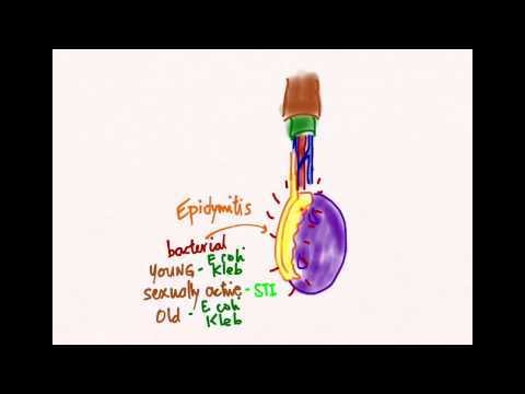 how to cure orchitis