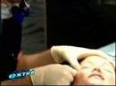 www_eyelash-transplant_com---EXTRA! www_eyelash-transplant_com---EXTRA!