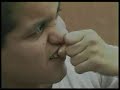 BECCASSINO, CHOQUES DE AFECTO EN PSIQUIÁTRICOS