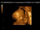 BLAKLEY BLAKLEY