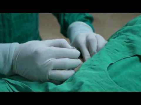 how to measure ffr