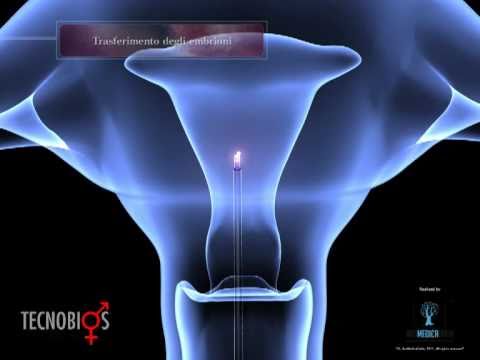 Video screenshot