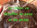 FiniLesPoux.com - les poux - les lentes FiniLesPoux.com - les poux - les lentes