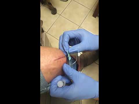 how to drain a knee